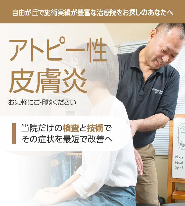 アトピー性皮膚炎